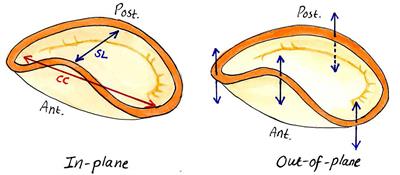 Mitral Annular Forces and Their Potential Impact on Annuloplasty Ring Selection